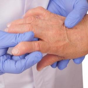Cirugía de mano reumática